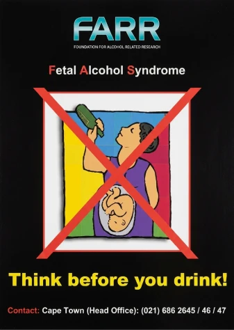 Syndrome d’alcoolisation fœtale en Afrique du Sud